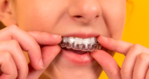 Ortodoncia estética