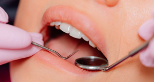 Rehabilitación oral